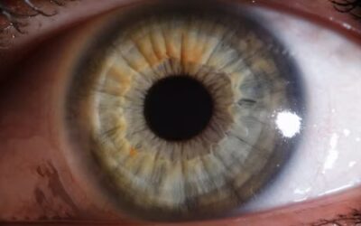 L’iridologie ! Quand nos yeux nous révèlent…
