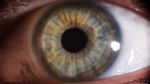 L’iridologie ! Quand nos yeux nous révèlent…